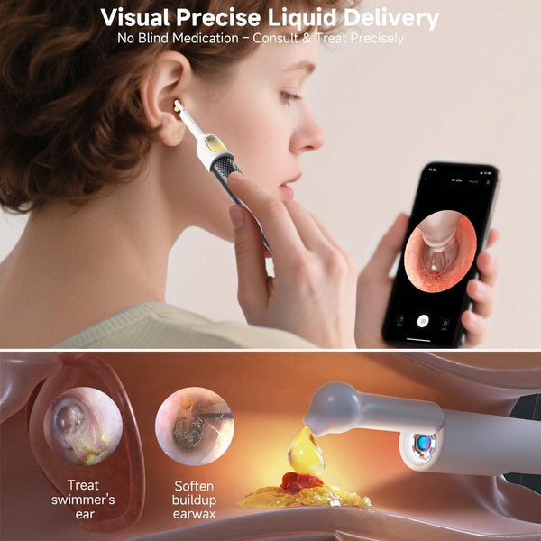 Rechargeable Smart Wireless Ear Camera Kit | Visual Ear Wax Removal Tool With Mobile Display